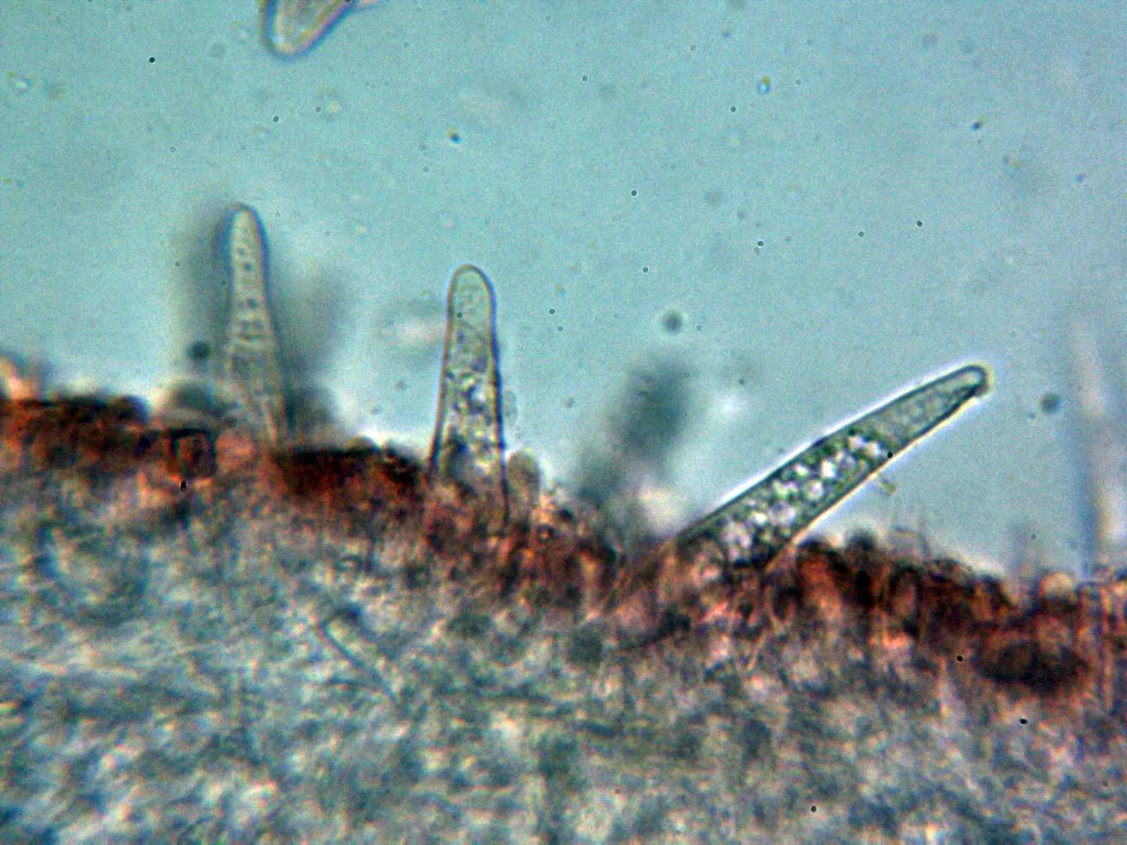 Microscopía de Strobilurus tenacellus - 10 - Queilocistidios 1